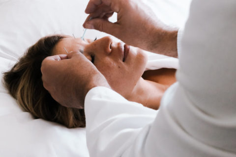 a woman lies on her back on top of a massage table. Her eyes are closed and she looks relaxed. A pair of hands performs acupuncture on her forehead