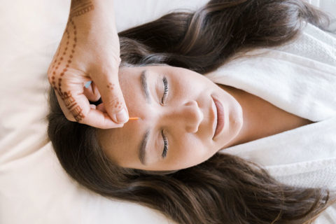 a woman with long brown hair wearing a white robe lies on a massage table. Her eyes are closed and she looks relaxed. There is a hand with henna tattoos gently pushing a small acupuncture needle into the space between her eyebrows