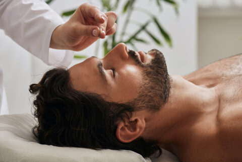 Acupuncturist inserts acupuncture needles into acupuncture point on male head for headaches. Traditional chinese medicine, reflexology